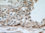 MAGEA3 Antibody in Immunohistochemistry (Paraffin) (IHC (P))