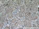 MAGEA3 Antibody in Immunohistochemistry (Paraffin) (IHC (P))