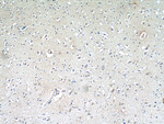 MGP Antibody in Immunohistochemistry (Paraffin) (IHC (P))