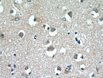 MGP Antibody in Immunohistochemistry (Paraffin) (IHC (P))