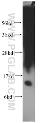 MGP Antibody in Western Blot (WB)