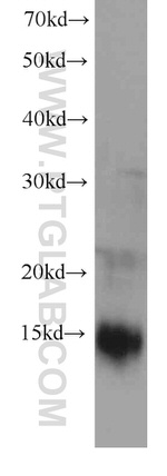 MGP Antibody in Western Blot (WB)