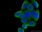 PLOD3 Antibody in Immunocytochemistry (ICC/IF)