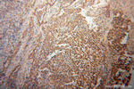 PLOD3 Antibody in Immunohistochemistry (Paraffin) (IHC (P))