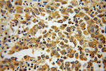 PLOD3 Antibody in Immunohistochemistry (Paraffin) (IHC (P))