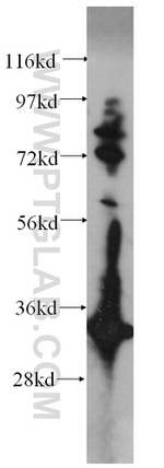 Follistatin Antibody in Western Blot (WB)