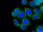 Stanniocalcin 2 Antibody in Immunocytochemistry (ICC/IF)