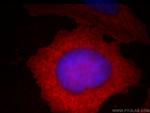 Stanniocalcin 2 Antibody in Immunocytochemistry (ICC/IF)