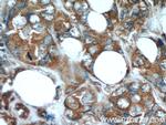 Stanniocalcin 2 Antibody in Immunohistochemistry (Paraffin) (IHC (P))