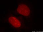 HDGF Antibody in Immunocytochemistry (ICC/IF)