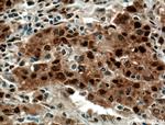 HDGF Antibody in Immunohistochemistry (Paraffin) (IHC (P))