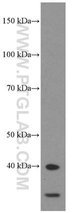 HDGF Antibody in Western Blot (WB)