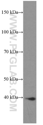 HDGF Antibody in Western Blot (WB)