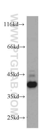 CXCR3B Antibody in Western Blot (WB)