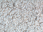 CXCR3B Antibody in Immunohistochemistry (Paraffin) (IHC (P))