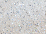 CXCR3B Antibody in Immunohistochemistry (Paraffin) (IHC (P))