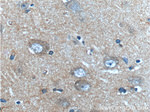 CXCR3B Antibody in Immunohistochemistry (Paraffin) (IHC (P))