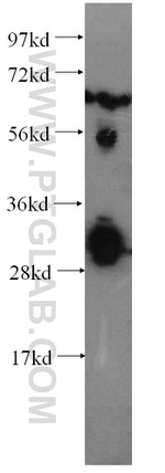 CXCR3B Antibody in Western Blot (WB)