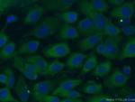 LGALS3BP Antibody in Immunocytochemistry (ICC/IF)