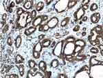 LGALS3BP Antibody in Immunohistochemistry (Paraffin) (IHC (P))