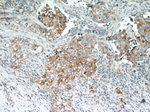 LGALS3BP Antibody in Immunohistochemistry (Paraffin) (IHC (P))