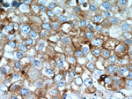 LGALS3BP Antibody in Immunohistochemistry (Paraffin) (IHC (P))