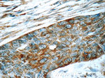 LGALS3BP Antibody in Immunohistochemistry (Paraffin) (IHC (P))