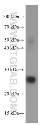 ERAB Antibody in Western Blot (WB)