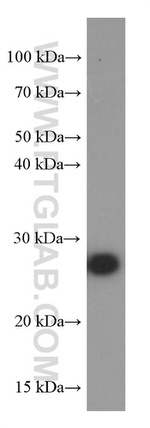 ERAB Antibody in Western Blot (WB)