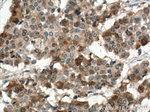 RRM1 Antibody in Immunohistochemistry (Paraffin) (IHC (P))