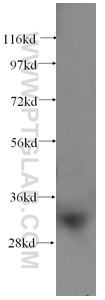 SULT1A1 Antibody in Western Blot (WB)