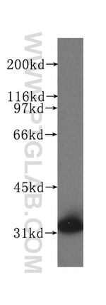 SULT1A1 Antibody in Western Blot (WB)