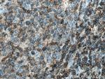 RAC2 Antibody in Immunohistochemistry (Paraffin) (IHC (P))