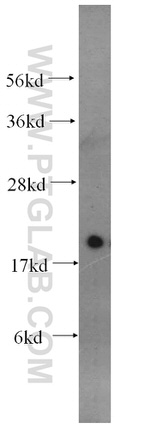 RAC2 Antibody in Western Blot (WB)