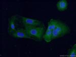 Fibulin 5 Antibody in Immunocytochemistry (ICC/IF)