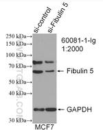 Fibulin 5 Antibody in Western Blot (WB)