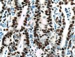 DACH1 Antibody in Immunohistochemistry (Paraffin) (IHC (P))