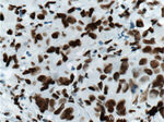 DACH1 Antibody in Immunohistochemistry (Paraffin) (IHC (P))