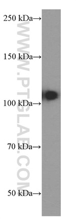 DACH1 Antibody in Western Blot (WB)