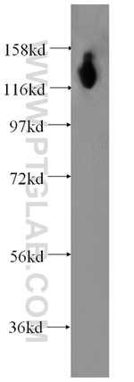 DGCR8 Antibody in Western Blot (WB)