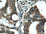 EEF1D Antibody in Immunohistochemistry (Paraffin) (IHC (P))