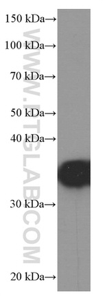 EEF1D Antibody in Western Blot (WB)