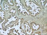 CTAGE1 Antibody in Immunohistochemistry (Paraffin) (IHC (P))