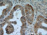 CTAGE1 Antibody in Immunohistochemistry (Paraffin) (IHC (P))