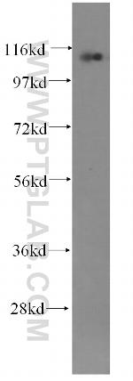 CTAGE1 Antibody in Western Blot (WB)