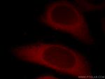 CTAGE1 Antibody in Immunocytochemistry (ICC/IF)