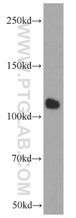 CTAGE1 Antibody in Western Blot (WB)