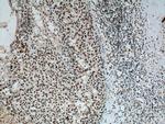 B23/NPM1 Antibody in Immunohistochemistry (Paraffin) (IHC (P))