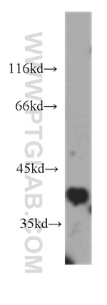 B23/NPM1 Antibody in Western Blot (WB)