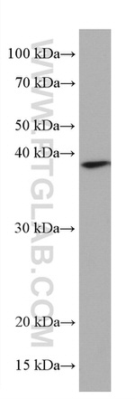 B23/NPM1 Antibody in Western Blot (WB)